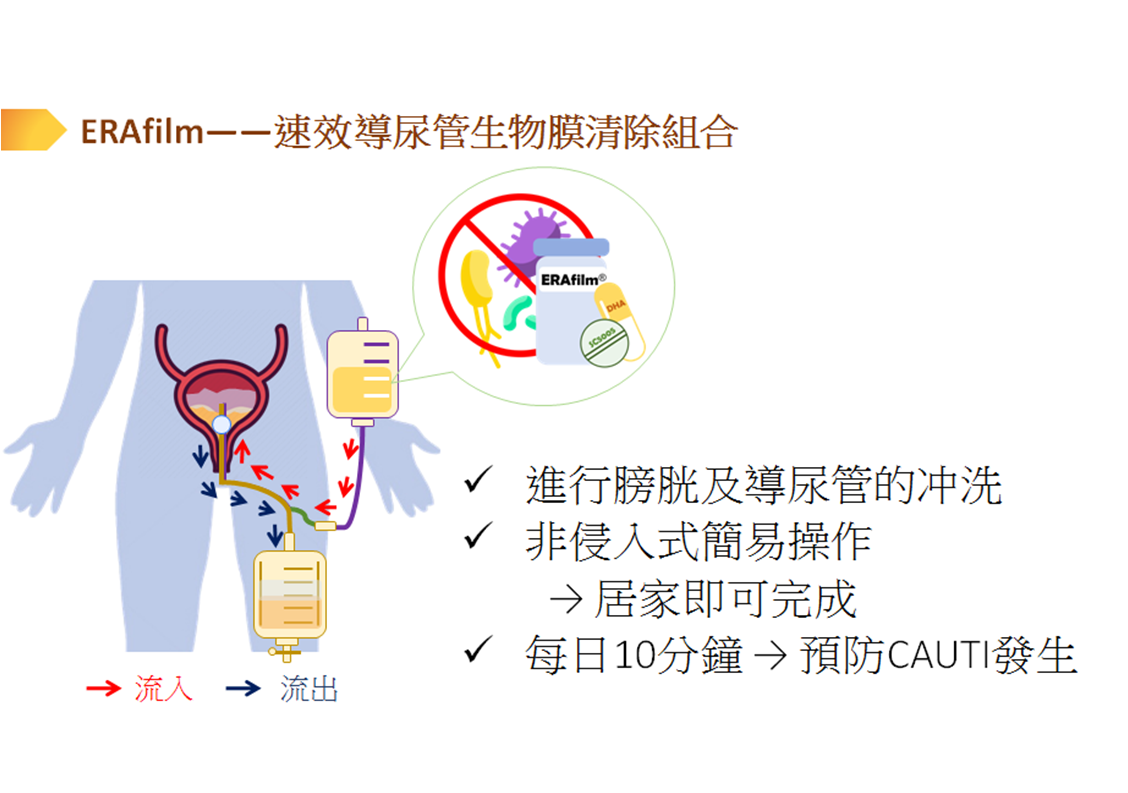 ERAfilm運用於導尿管生物膜清除組合說明。（圖／國科會提供）